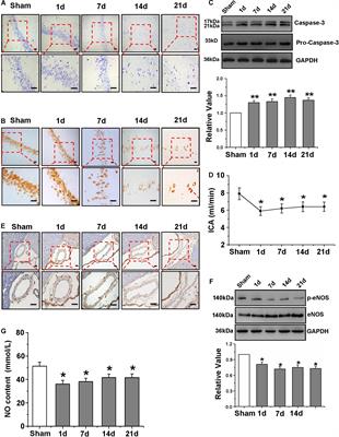 Shear Stress Rescued the Neuronal Impairment Induced by Global Cerebral Ischemia Reperfusion via Activating PECAM-1-eNOS-NO Pathway